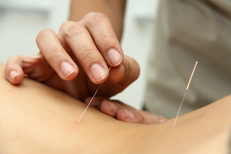 Acupuntura e reiki agora têm explicação científica