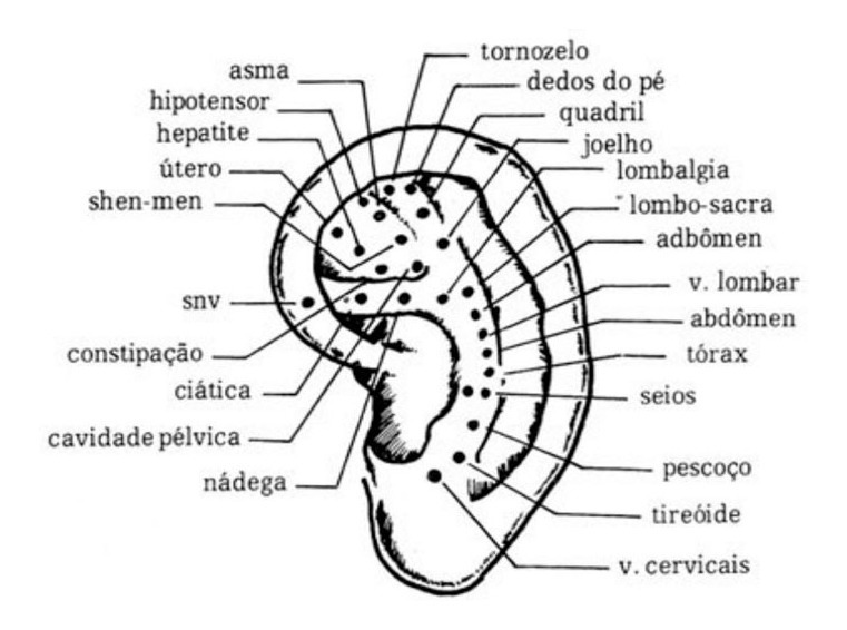 Auriculoterapia - Indicação x Contra Indicação