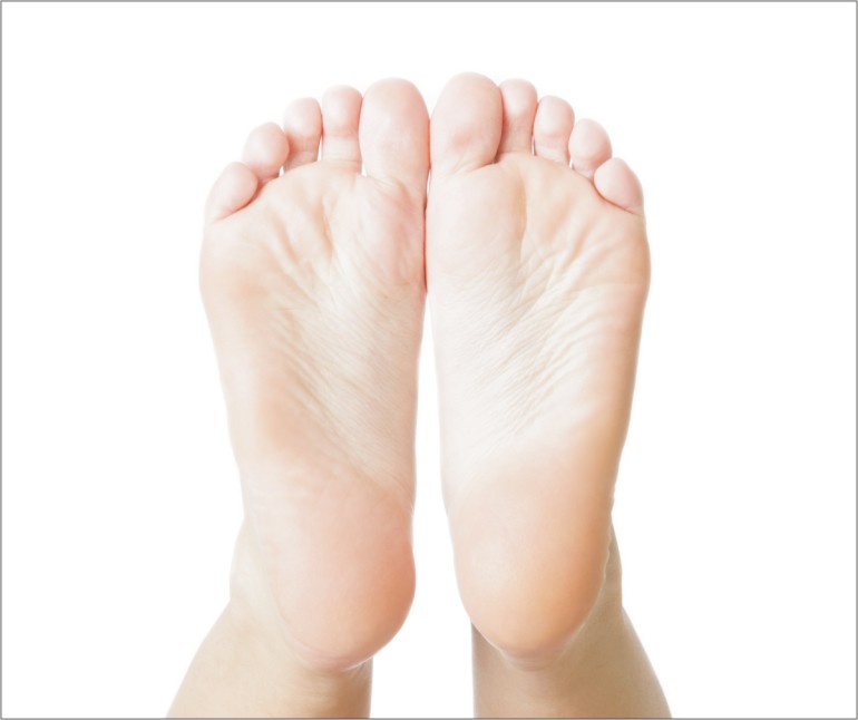 Diga adeus ao calcanhar rachado!