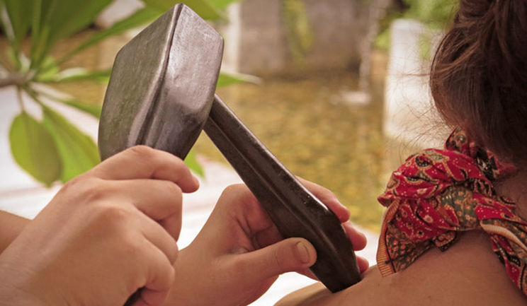 Tok Sen Brasil associado com a Acupuntura