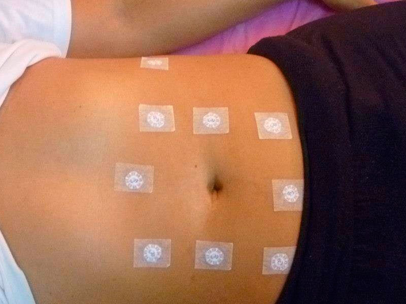 Acupuntura sem dor é possível?